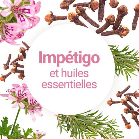 Utiliser les huiles essentielles contre l impétigo