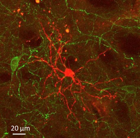 Neurons [image] Eurekalert Science News Releases