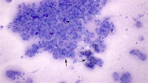 Mast Cells Archives Eclinpath