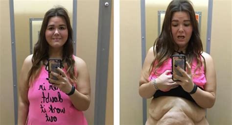 Woman Shares Honest Photos of 180-Pound Weight Loss