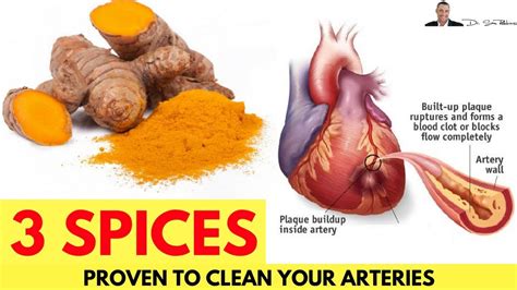 🌿 3 Spices Proven To Cleanse Your Arteries By Dr Sam Robbins Youtube