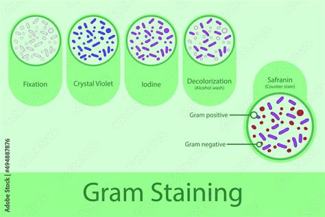 Fototapeta Diagram Showing Gram Staining Technique Steps Microbiology