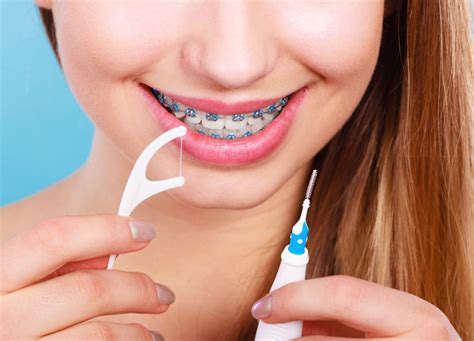 Orthodontic Spacers Types Uses And Importance In Creating Space For