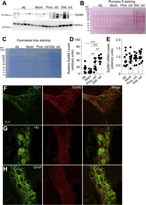 The Ephrin Receptor EphB2 Regulates The Connectivity And Activity Of