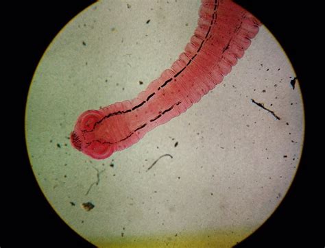 ¿qué Es La Infección Por Toxocariasis ¿qué Síntomas Tiene