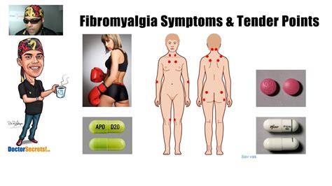 Fibromyalgia Symptoms And Tender Points Test Secrets Youtube