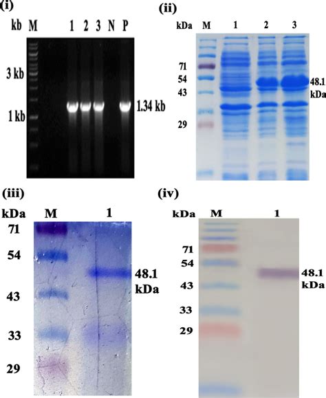 I Colony Pcr Of E Coli Bl21 De3 Bacterial Cells Transformed With