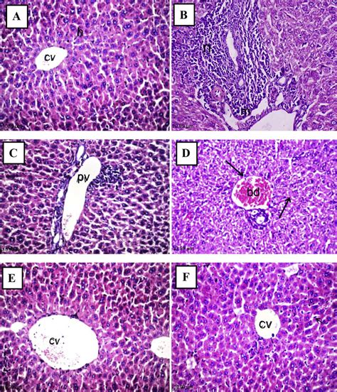 Light Photomicrograph Of Hematoxylin And Eosin Stained Liver Sections