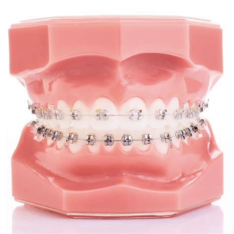 Legend Mini Rhodium Mbt Mandibular Gc Orthodontics Inc