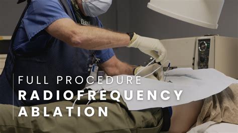 Radiofrequency Ablation Full Procedure Lumbar Youtube