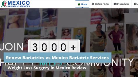 Renew Bariatrics Vs Other Bariatric Centers In Mexico