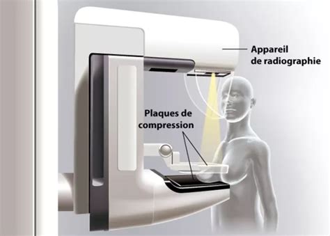 La Mammographie Radiologie Al Hakim Tanger