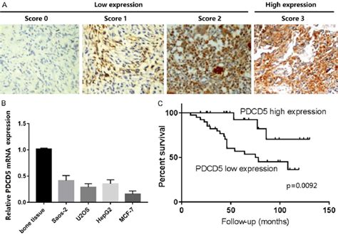 Strong Pdcd5 Expression In Os Correlates With Better Patient Overall