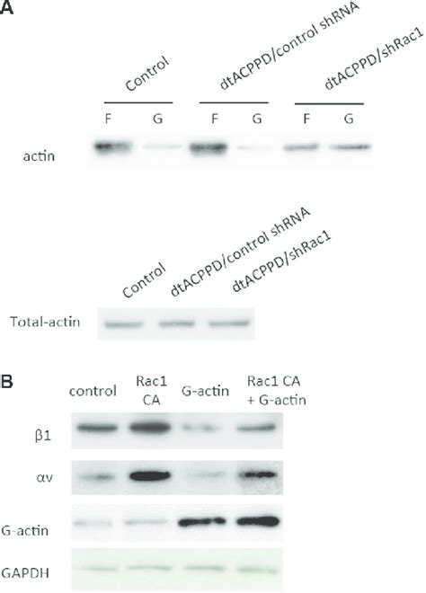 Rac1 regulates cell to matrix adhesion via cytoskeletal reorganization ... 
