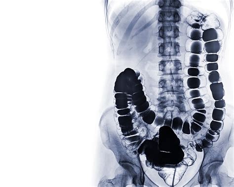 Fluoroscopy What Is It And Why Do You Need One Our Blog