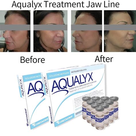 Good Effect Aqualyx Solution Aqualyx Fat Dissolving Injections