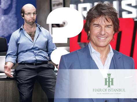 Tom Cruise Hair Transplant: Hollywood's Best Kept Secret?