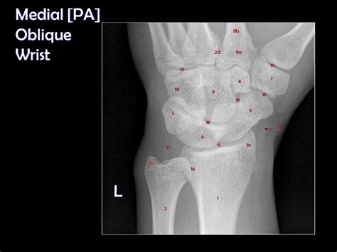 Medial PA Oblique View Of Wrist Diagram Quizlet