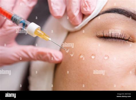 Cosmetologist Makes Rejuvenating Anti Wrinkle Injections On The Face Of