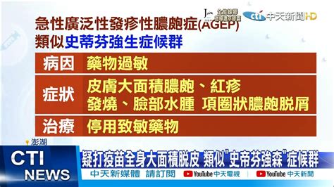 【每日必看】澎湖首例 男打完莫德納 全身大面積冒膿皰脫皮中天新聞ctinews 20211027 Youtube