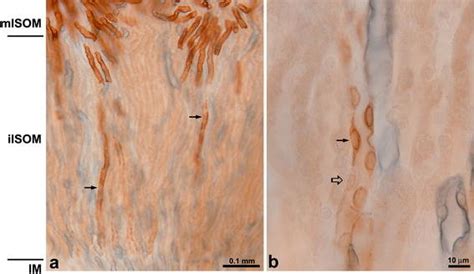 Light micrographs of 50 µm thick vibratome sections illustrating double