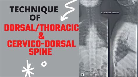 Technique Of Dorsal Or Thoracic And Cervico Dorsal Spine Ep 64 X Ray Cervico Thoracic Spine