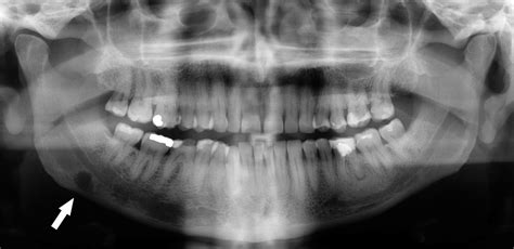 What Are The Benefits Of A Dental Radiography