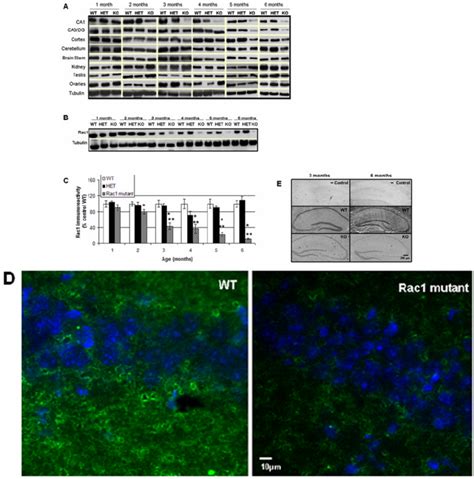 Loss Of Rac1 Protein And MRNA Expression In A Newly Developed Forebrain