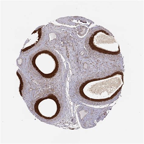 Tissue Expression Of Phgdh Staining In Epididymis The Human Protein