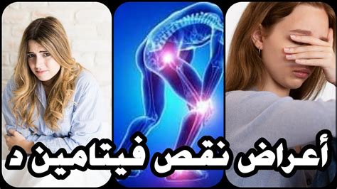 أعراض نقص فيتامين د 10 علامات تحذيرية أنك تعاني من نقص فيتامين دال