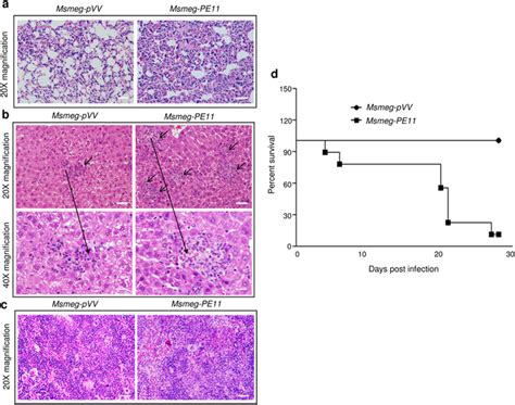 Balbc Mice Infected With Msmeg Pe11 Showed More Organ Pathology And