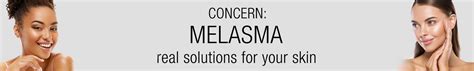 Melasma Treatments New Jersey Slate Medspa
