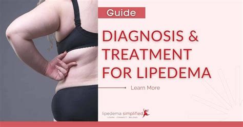 Diagnosis and Treatment Options for Lipedema - Jane Advice - Medium