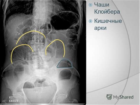 Презентация на тему: "Лучевая диагностика. Ультразвук Рентгенография ...