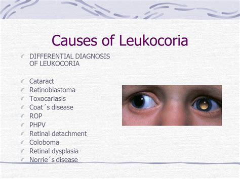 Leukocoria