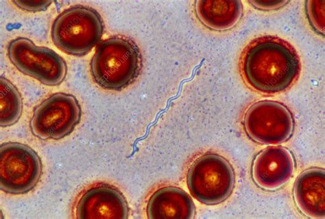 Lyme Disease Bacteria Borrelia Stock Image B2200888 Science