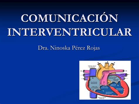 Comunicación Interventricular Ppt