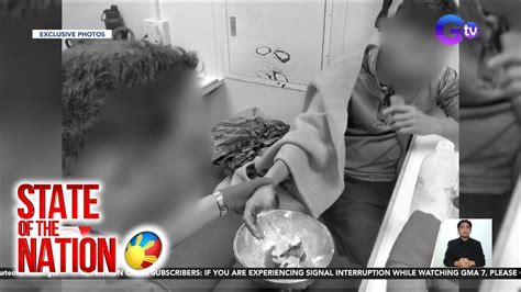 Sundalong Pilipino Naputulan Ng Daliri Sa Gitna Ng Pangha Harass Ng