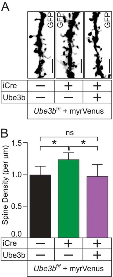 The Kaufman Oculocerebrofacial Syndrome Protein Ube B Regulates Synapse