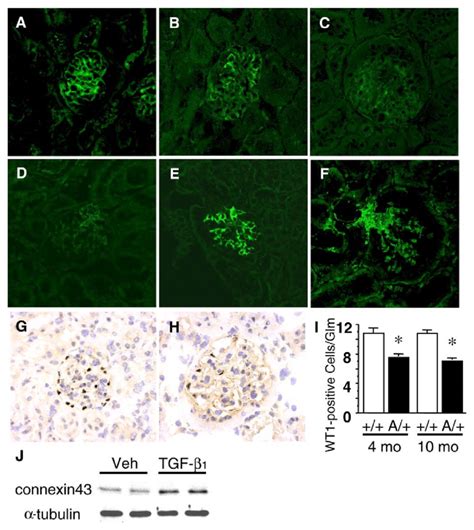 Immunostaining Of Podocyte Markers Nephrin A C Connexin43 D F