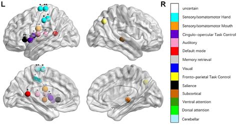 Frontiers Disrupted Brain Connectivity Networks In Aphasia Revealed