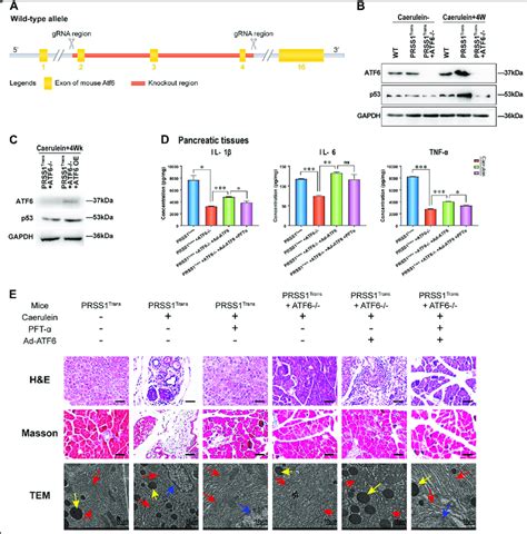 Regulation Of P53 Expression And Cp Progression By Atf6 In The Prss1 Cp