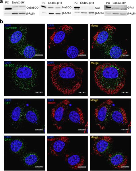 Antioxidative Enzyme Protein Expression In Endoc H Beta Cells A