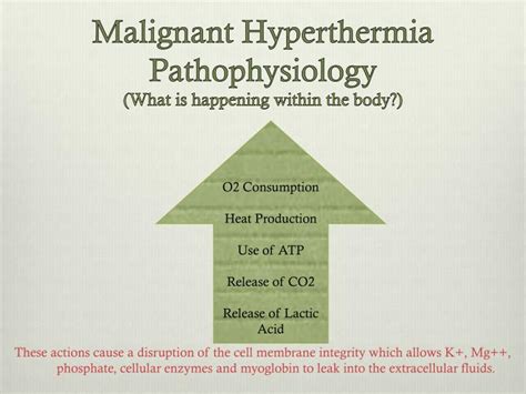 Ppt Malignant Hyperthermia Keeping Our Patients Safe Powerpoint Presentation Id 2000233