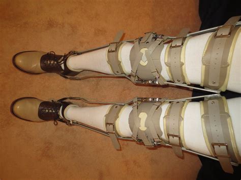 Leg Braces Pair Full Leg Metal And Leather Polio Etsy