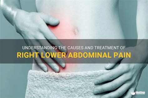 Understanding The Causes And Treatment Of Right Lower Abdominal Pain