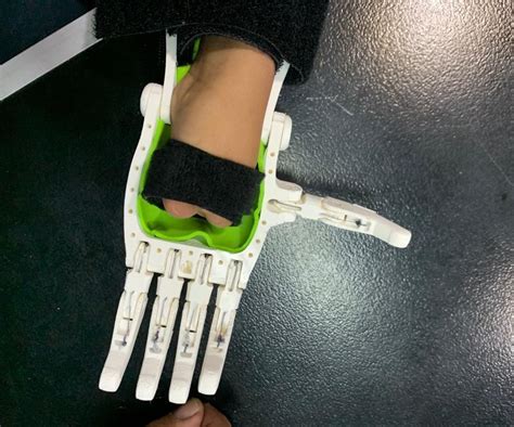 3d Print Prosthetic Hands In The Classroom 6 Steps Instructables