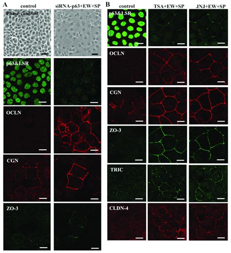 A Phase Contrast And Immunocytochemical Staining For P63