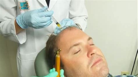 Treatment uses your own blood plasma to regrow hair | wwltv.com