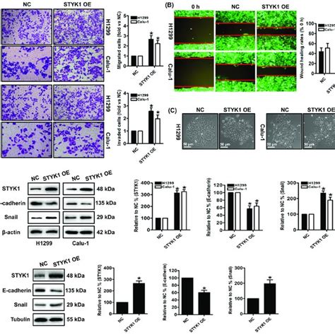 Correlation Between Styk1 And Spint2 Expression In Nsclc Tissue